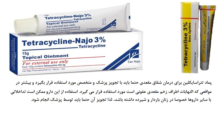پماد برای زخم مقعدی در اثر یبوست
